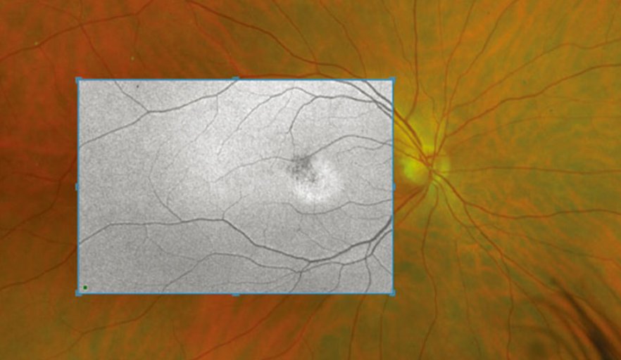 広角眼底カメラ