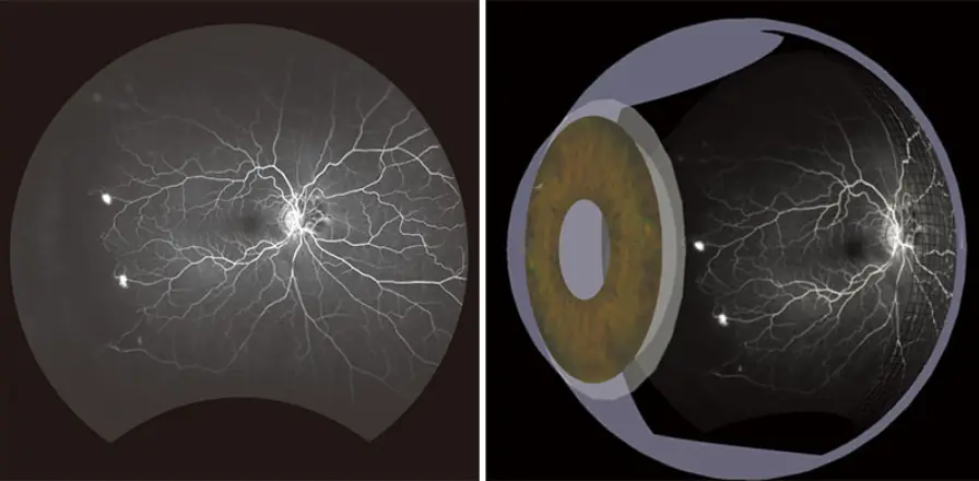 網膜構造と眼底画像の比較
