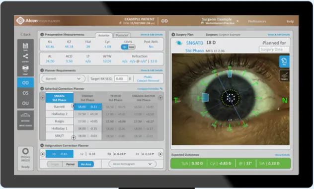 ARGOS 計測画面とレンズ計画