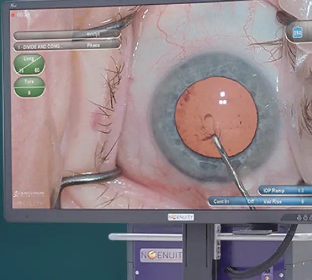 NGENUITY 手術映像表示